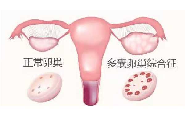 广州有做代孕的机构 广州南方医院试管成功率多少来看看这些影响你的因素 ‘