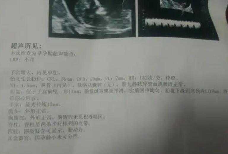 广州是否有医院提供卵子 广州私立医院做试管婴儿该怎么选择? ‘2.2x0.9的孕囊