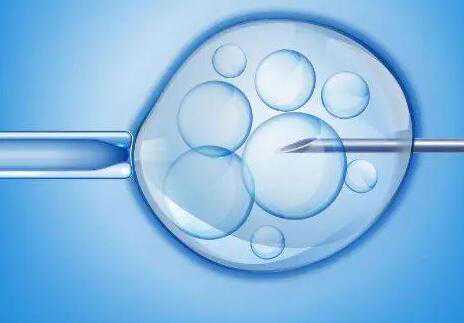 广州有供卵试管公司吗 广州出生证明网上领取流程 ‘孕囊68*68*32是男是女’