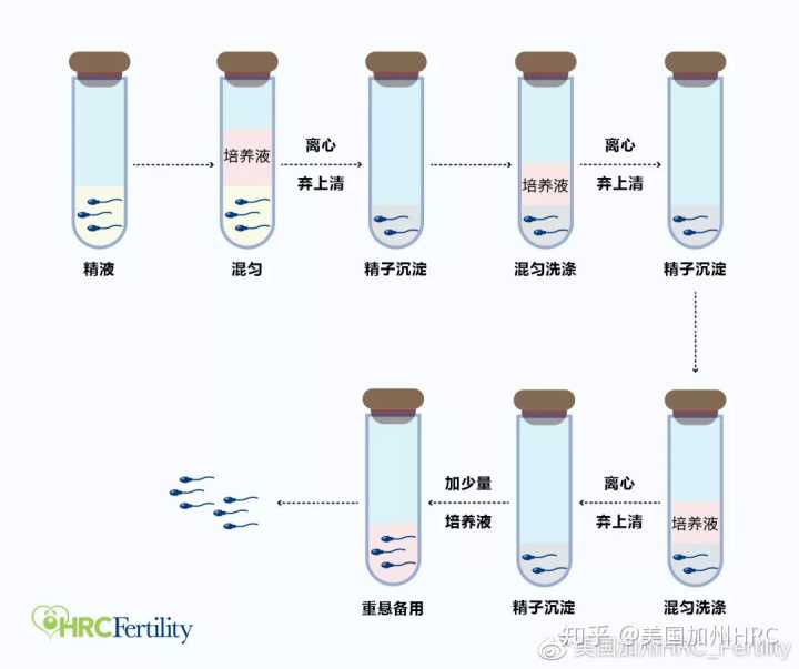 广州第三代试管婴儿多少钱,到广州做三代试管要什么条件？所有人都能做吗