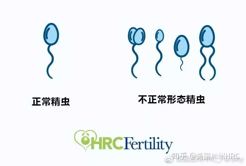 广州第三代试管婴儿多少钱,到广州做三代试管要什么条件？所有人都能做吗